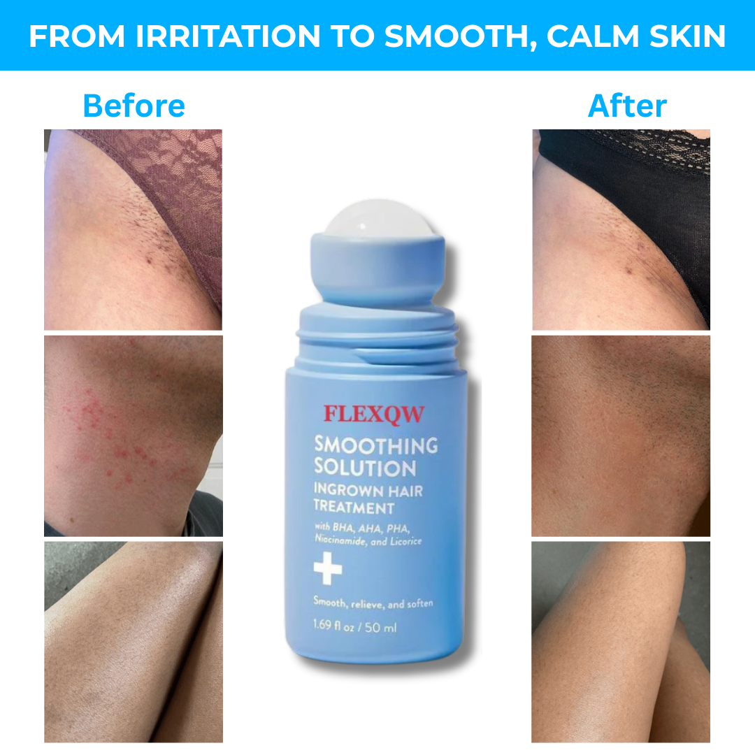 FLEXQW™ Smoothing Solution