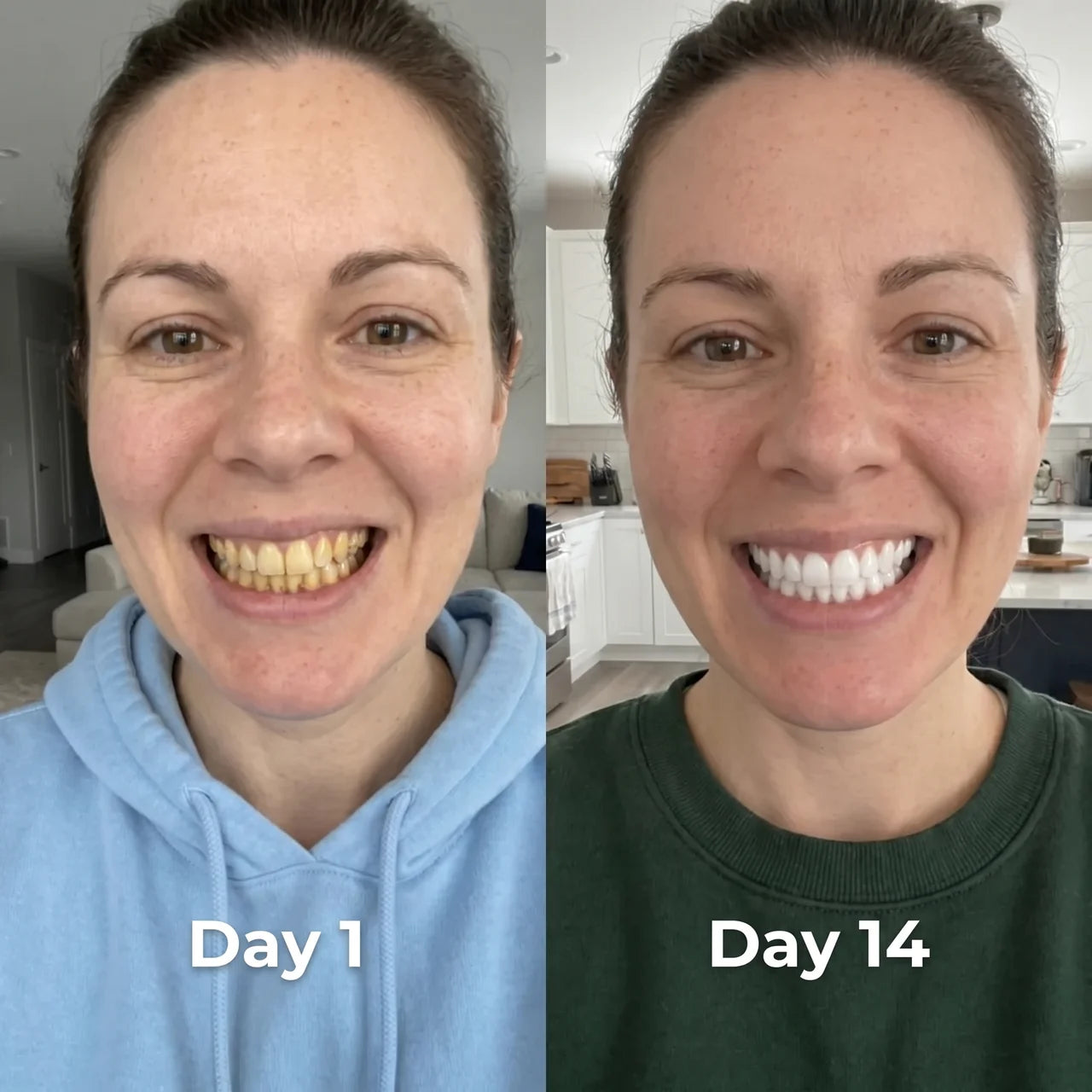 Hismile Whitening Serum