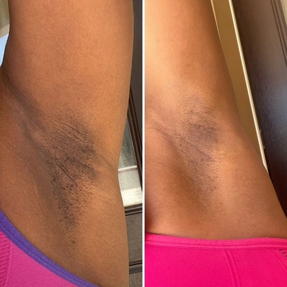 Snow Bleach Body Cream
