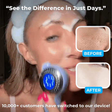 SPA Facial Cleaner