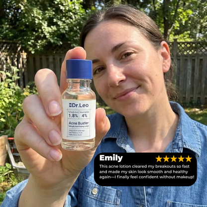 Acne Buster Lotion