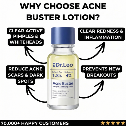 Acne Buster Lotion