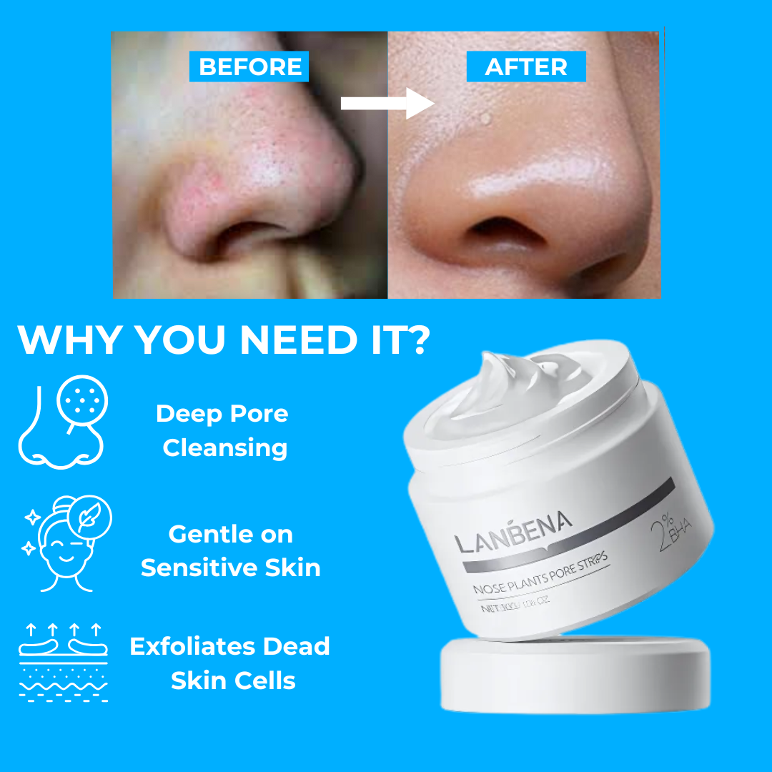 BlackOut™- Blackhead Remover Cream