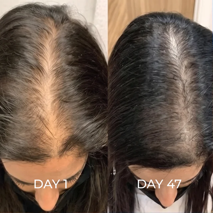 ReGene -Hair Growth Cap