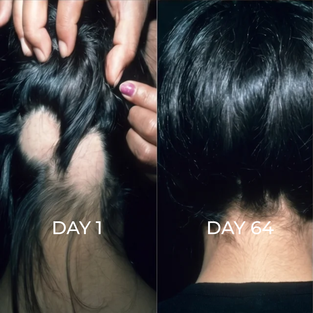 ReGene -Hair Growth Cap