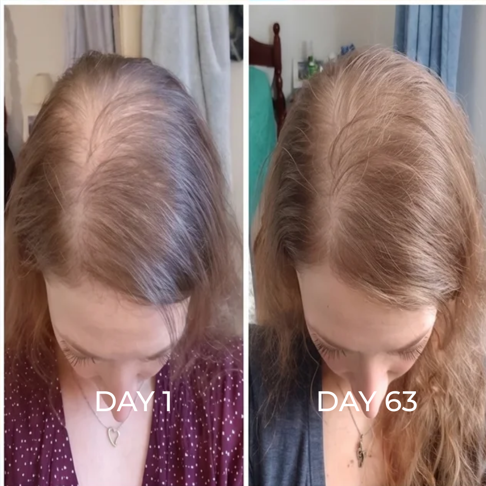ReGene -Hair Growth Cap