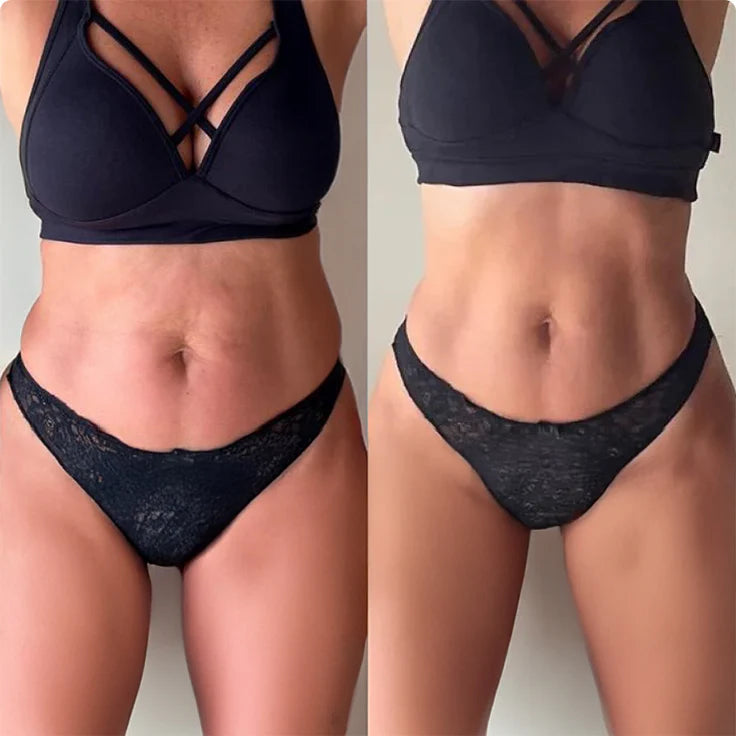 SkinSculpt Pro™