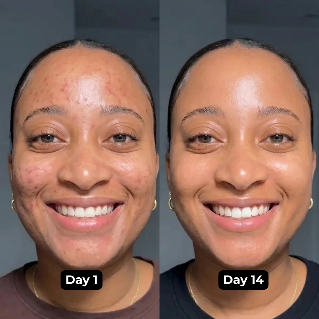 Lakerain -Turmeric Serum