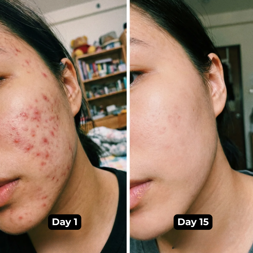 Lakerain -Turmeric Serum