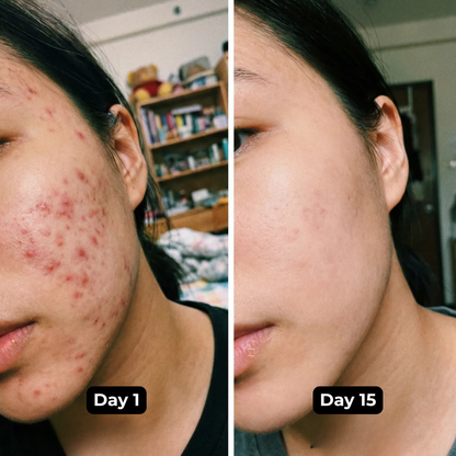 Lakerain -Turmeric Serum