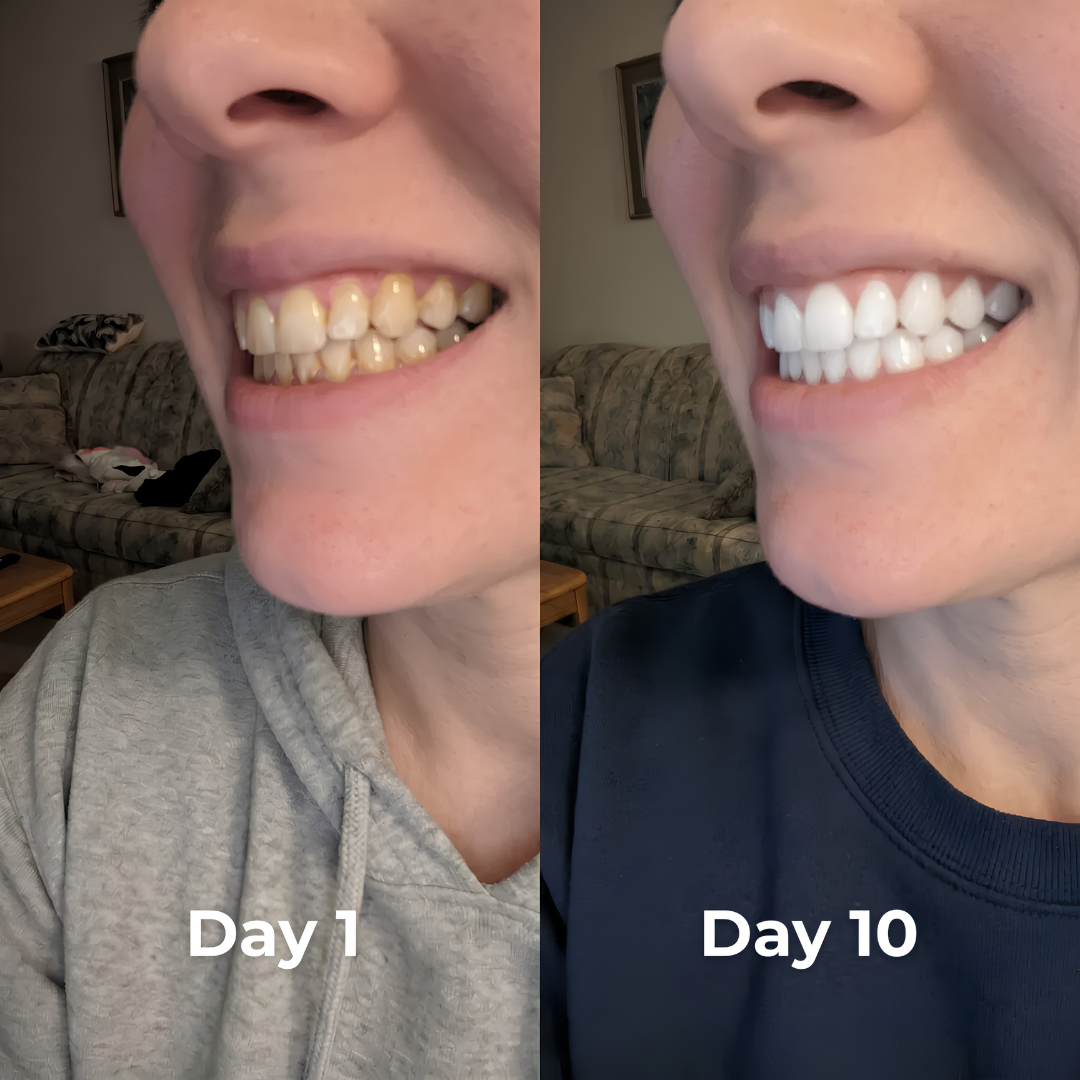 Foam Whitening Paste