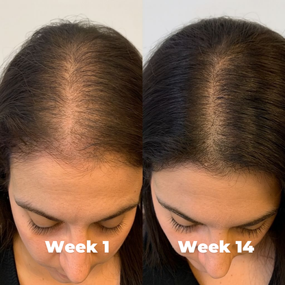 Beyond Collagen Capsules