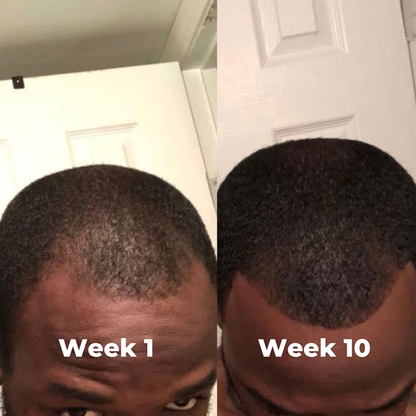 Jaysuing - Hair Growth Serum