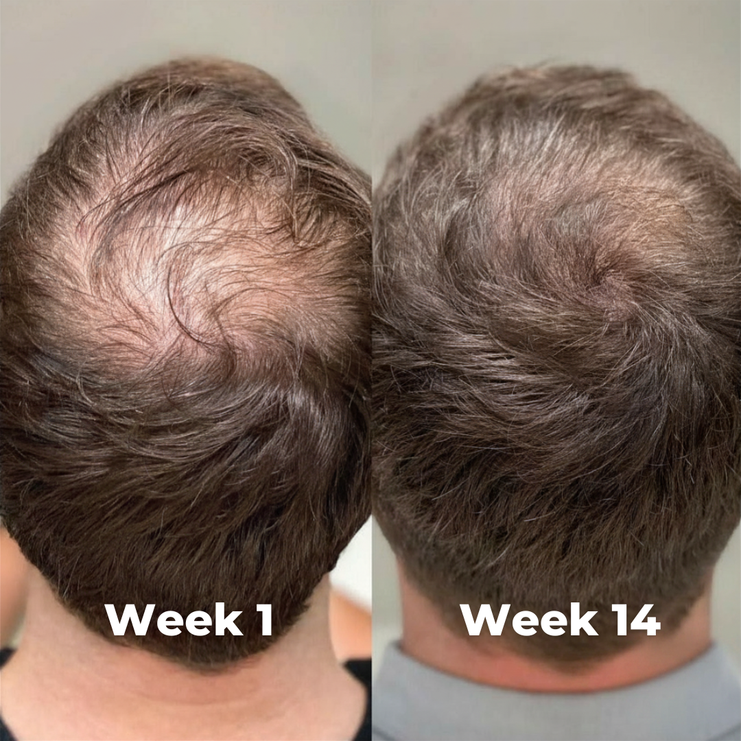 Jaysuing - Hair Growth Serum