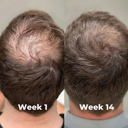 Jaysuing - Hair Growth Serum