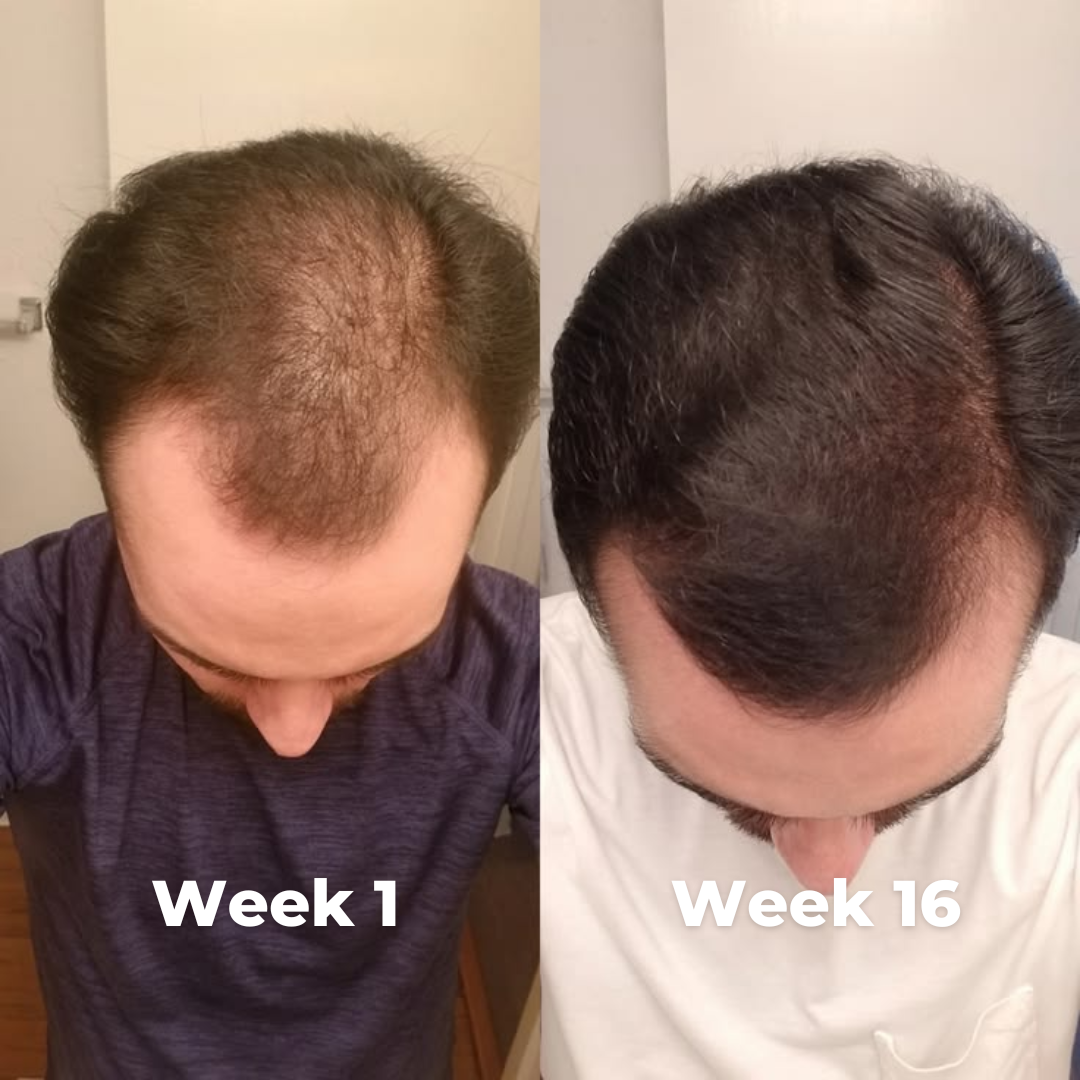 Jaysuing - Hair Growth Serum