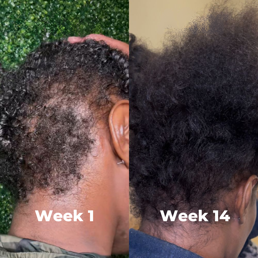Jaysuing -Hair Growth Serum