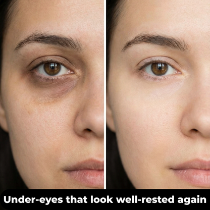Lumi Eye Pro