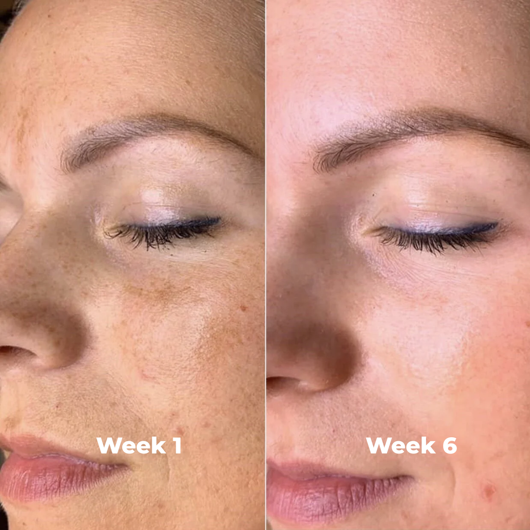 Arbutin Brightening Cream
