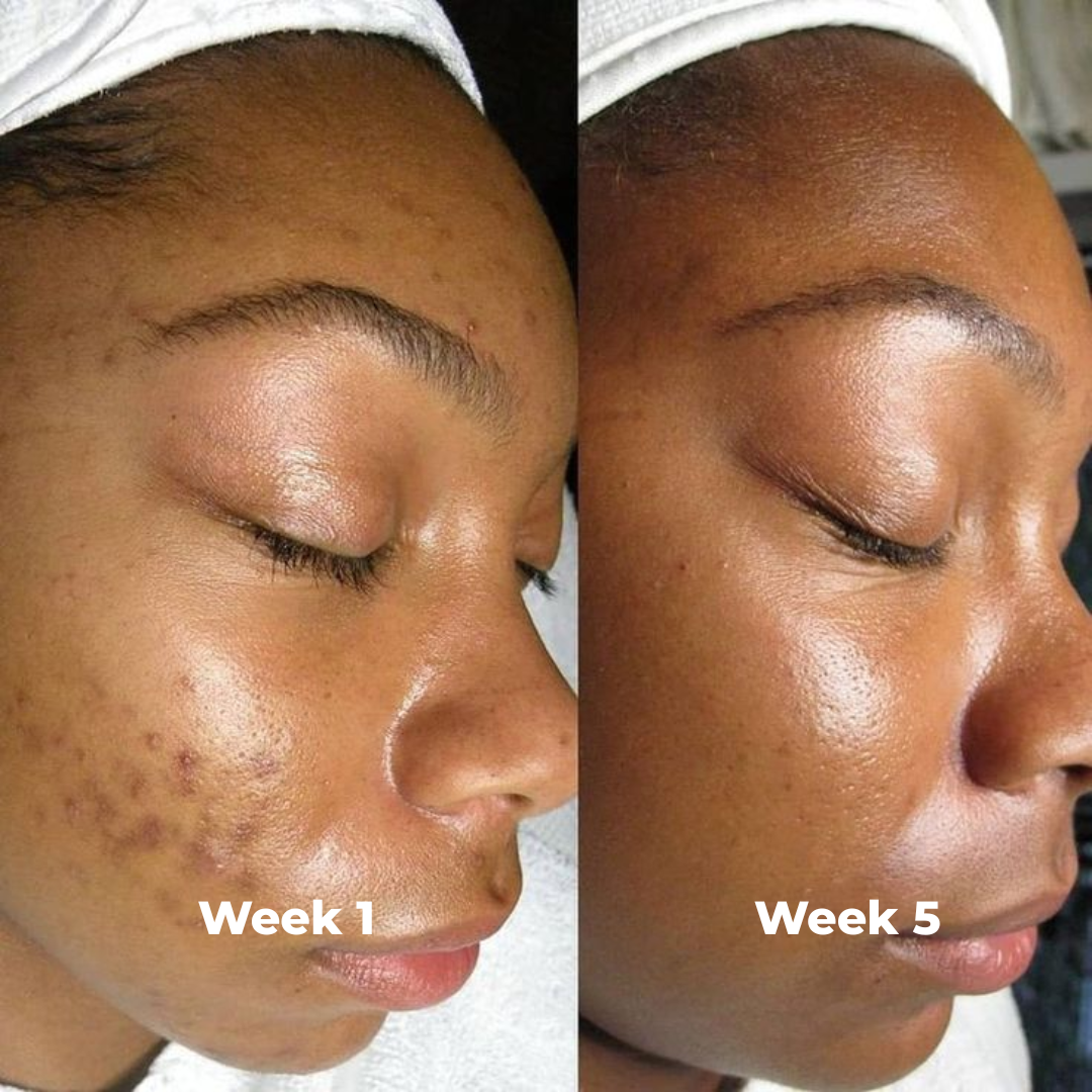 Arbutin Brightening Cream