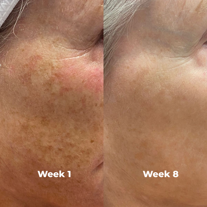 Arbutin Brightening Cream