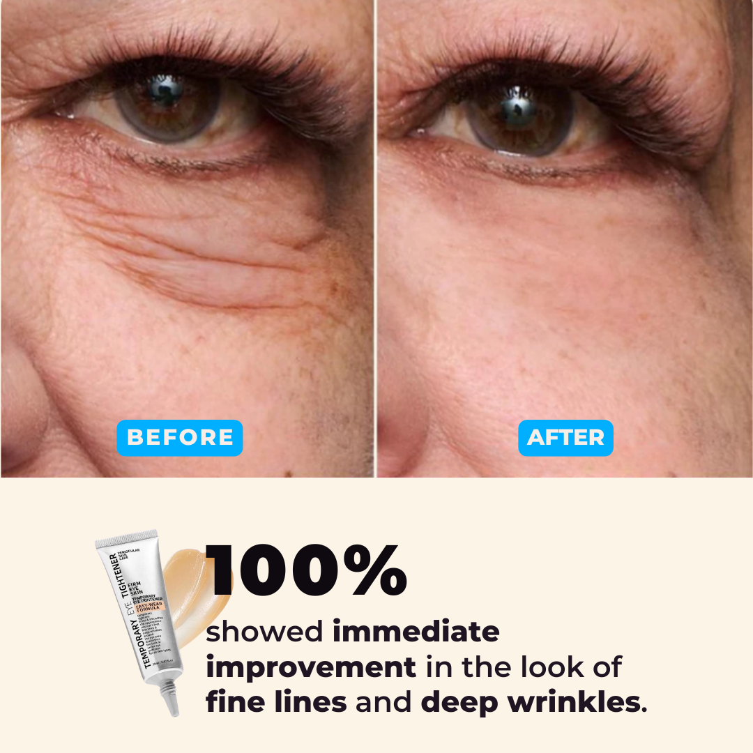 Eye Tightener