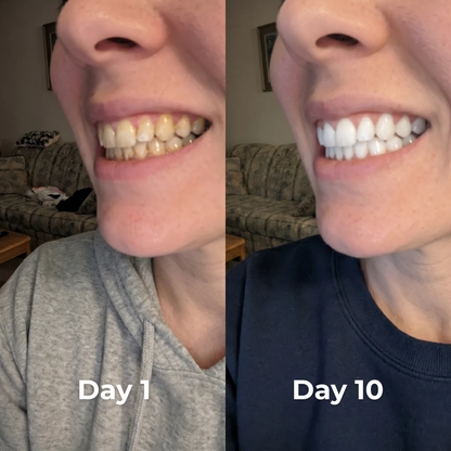 Hismile Whitening Serum