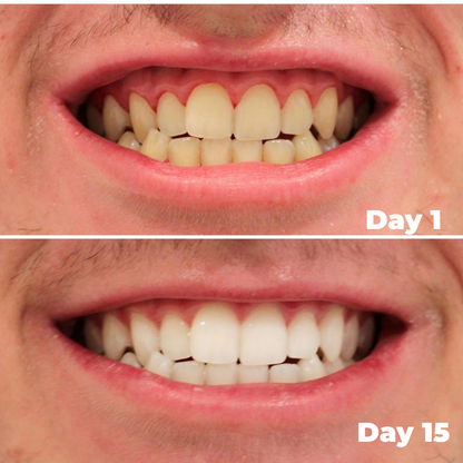 Hismile Whitening Serum