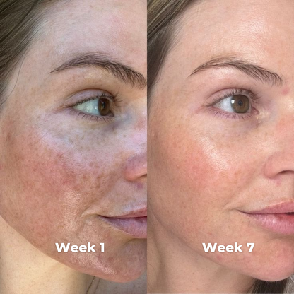 NeoContour-Facial Device