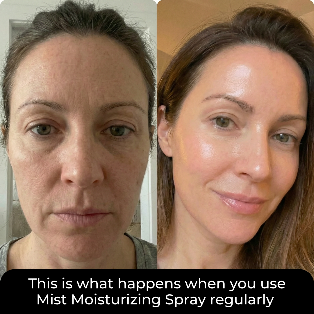 Mist Moisturizing Spray