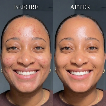 Mist Moisturizing Spray