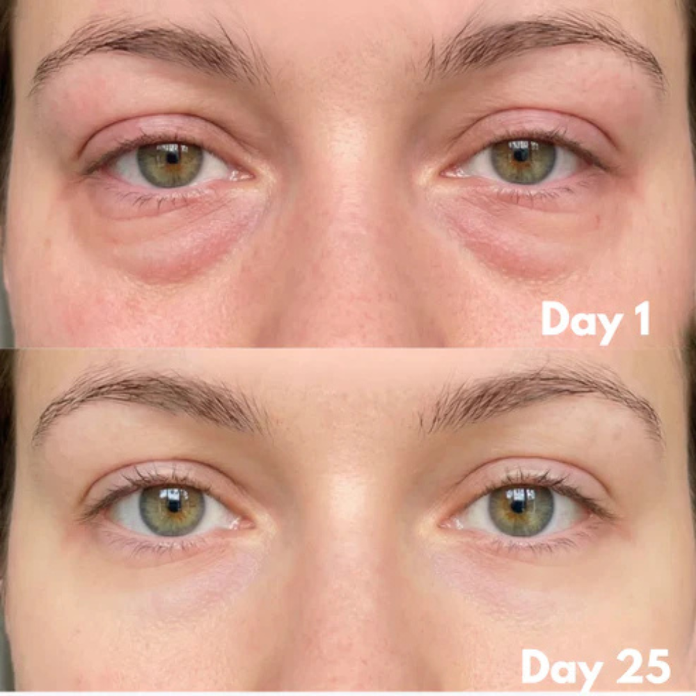 MicroLift Pro