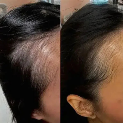 EMS Glow Comb