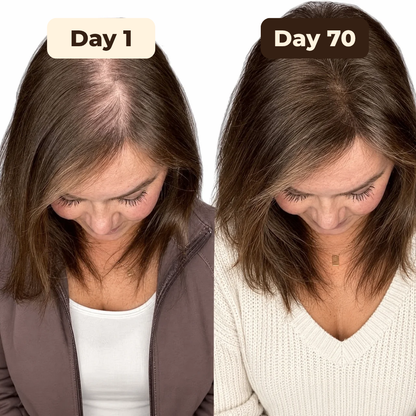 HairViva™ – Pumpkin Seed Oil Plus