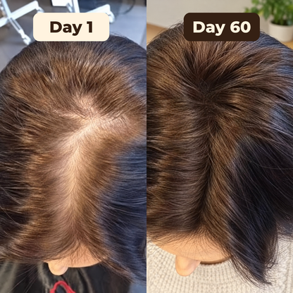 HairViva™ – Pumpkin Seed Oil Plus