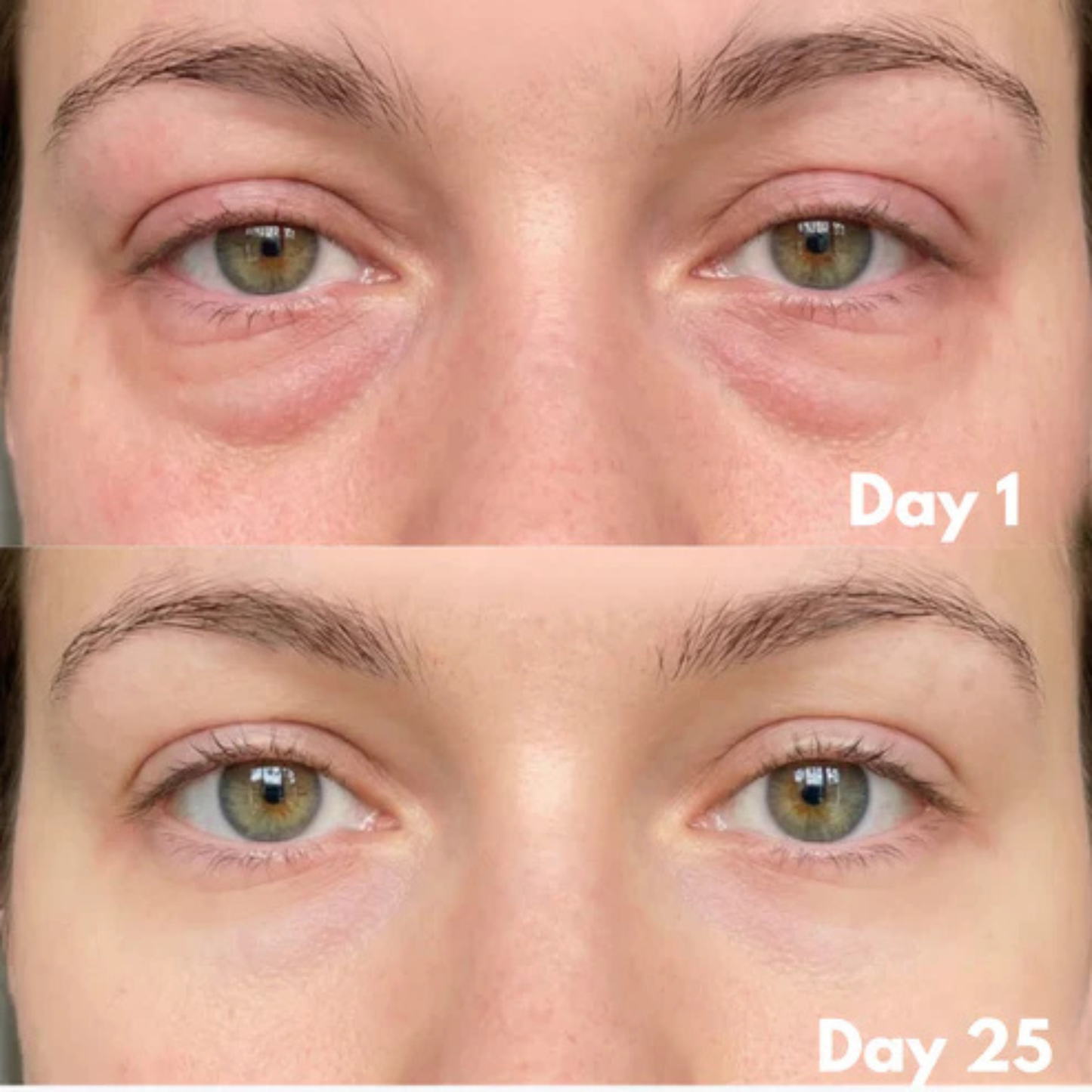 Skin Glow Facial Device