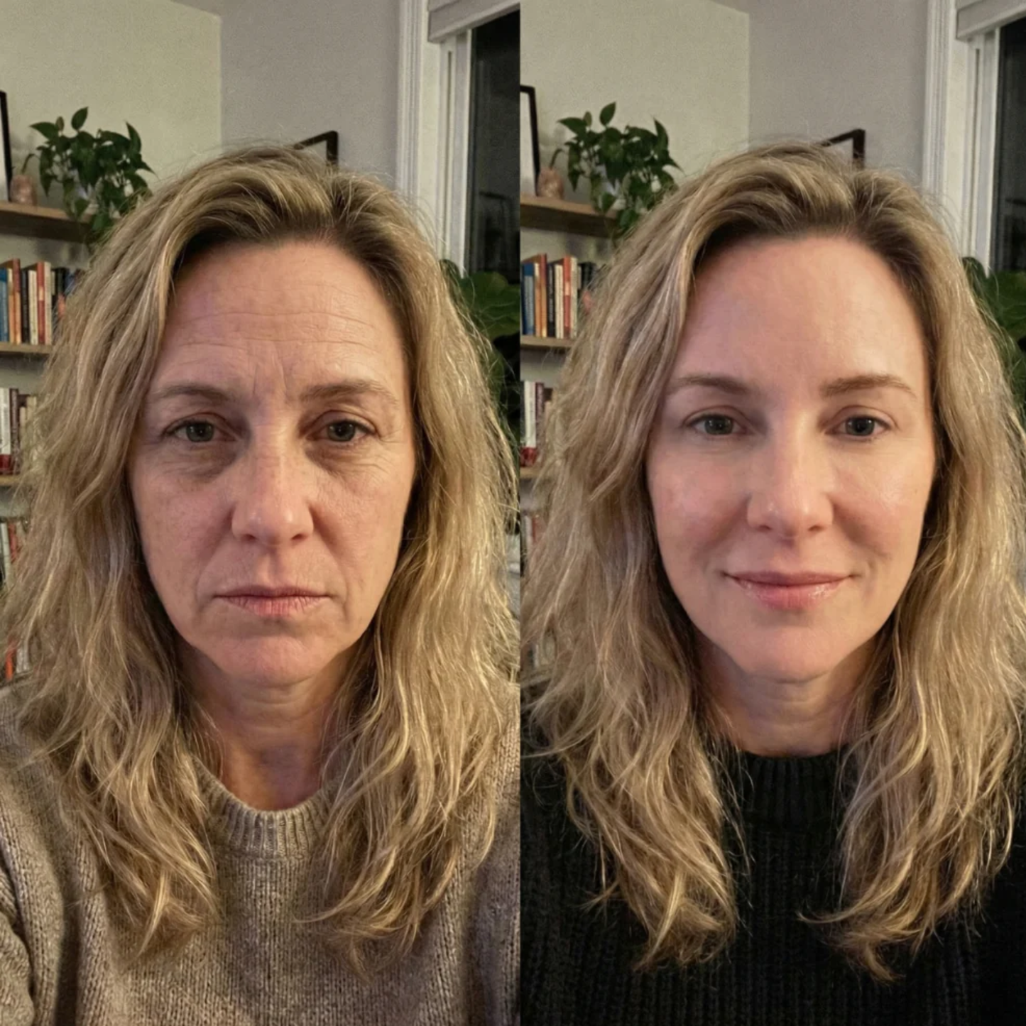 Skin Glow Facial Device