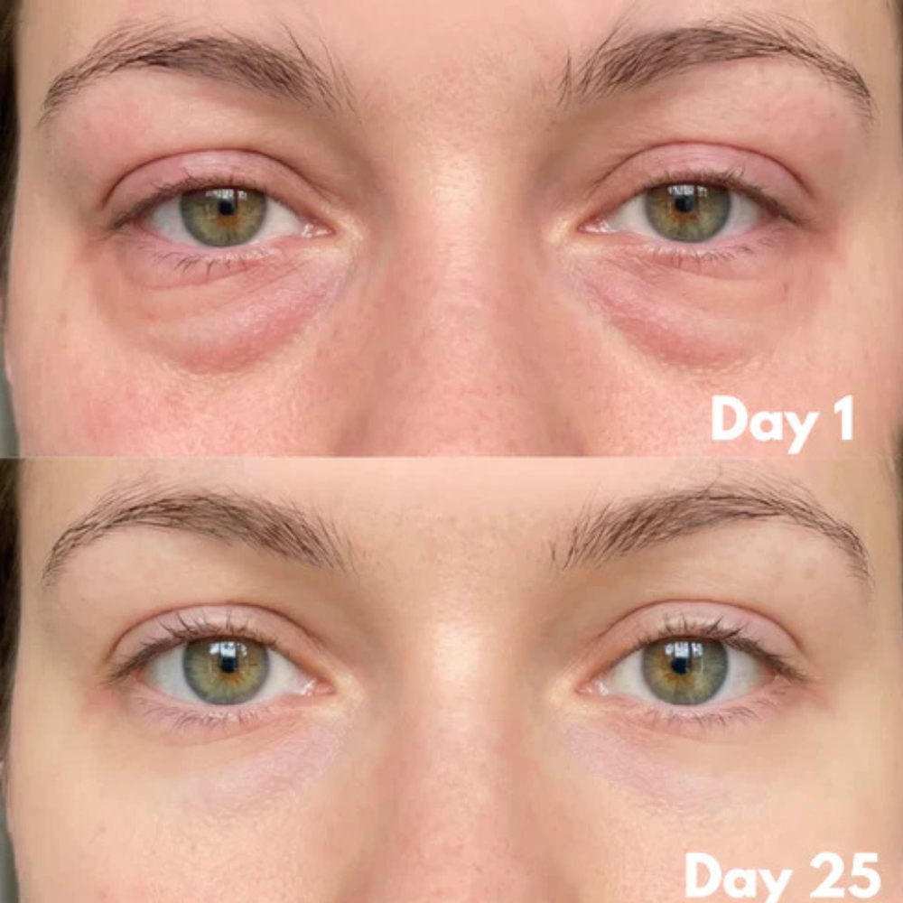 Contour Lift Pro