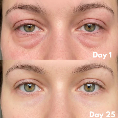 Contour Lift Pro