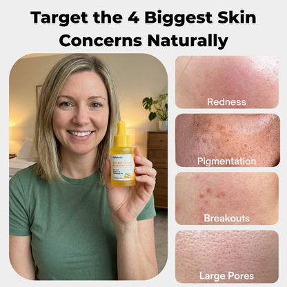 Lakerain -Turmeric Serum