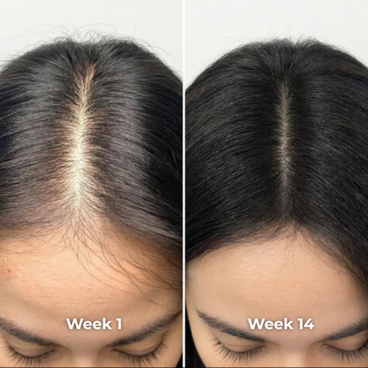 Hair Regrowth Comb