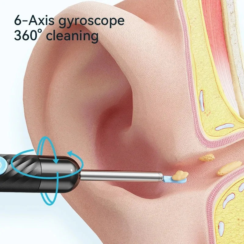 Ear Cleaner