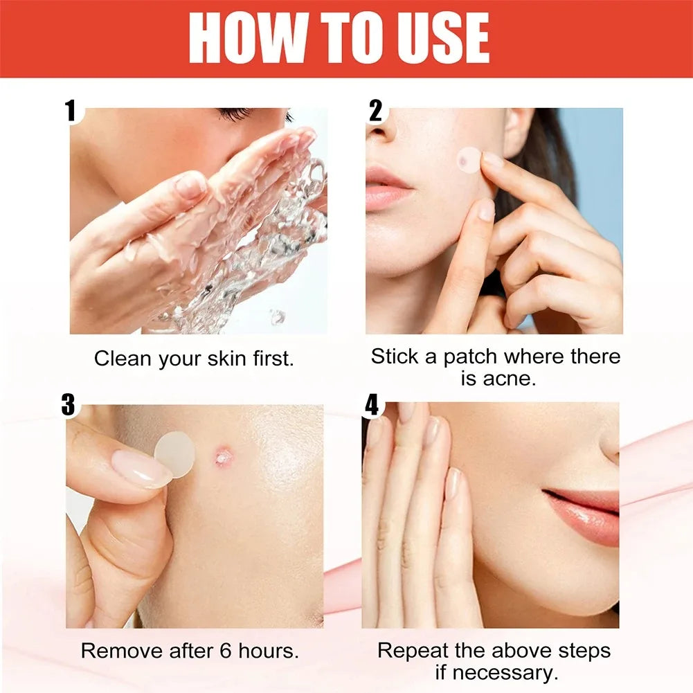 Pimple Acne Patches
