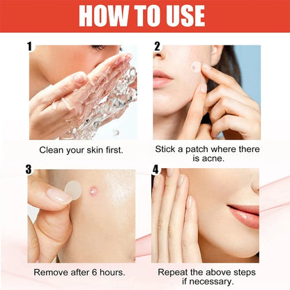 Pimple Acne Patches