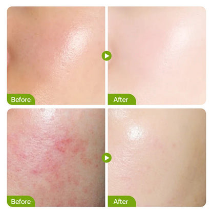 DermaPure Cream