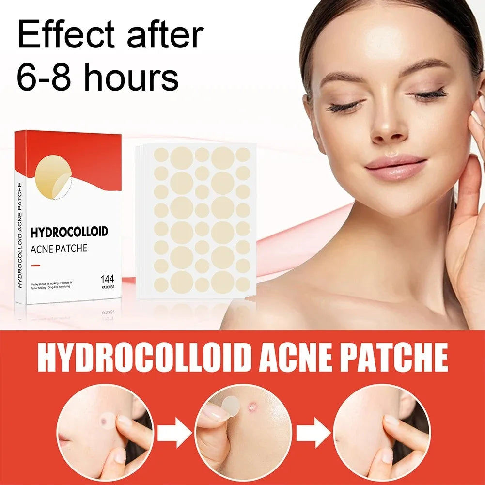 Pimple Acne Patches