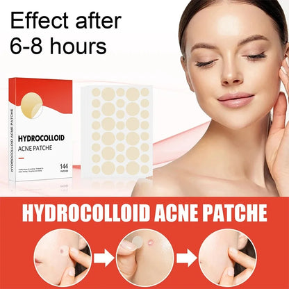 Pimple Acne Patches
