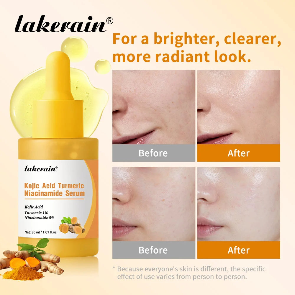 Turmeric Serum