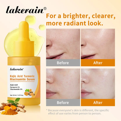 Turmeric Serum