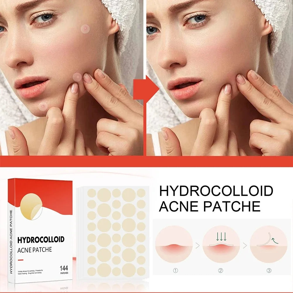 Pimple Acne Patches